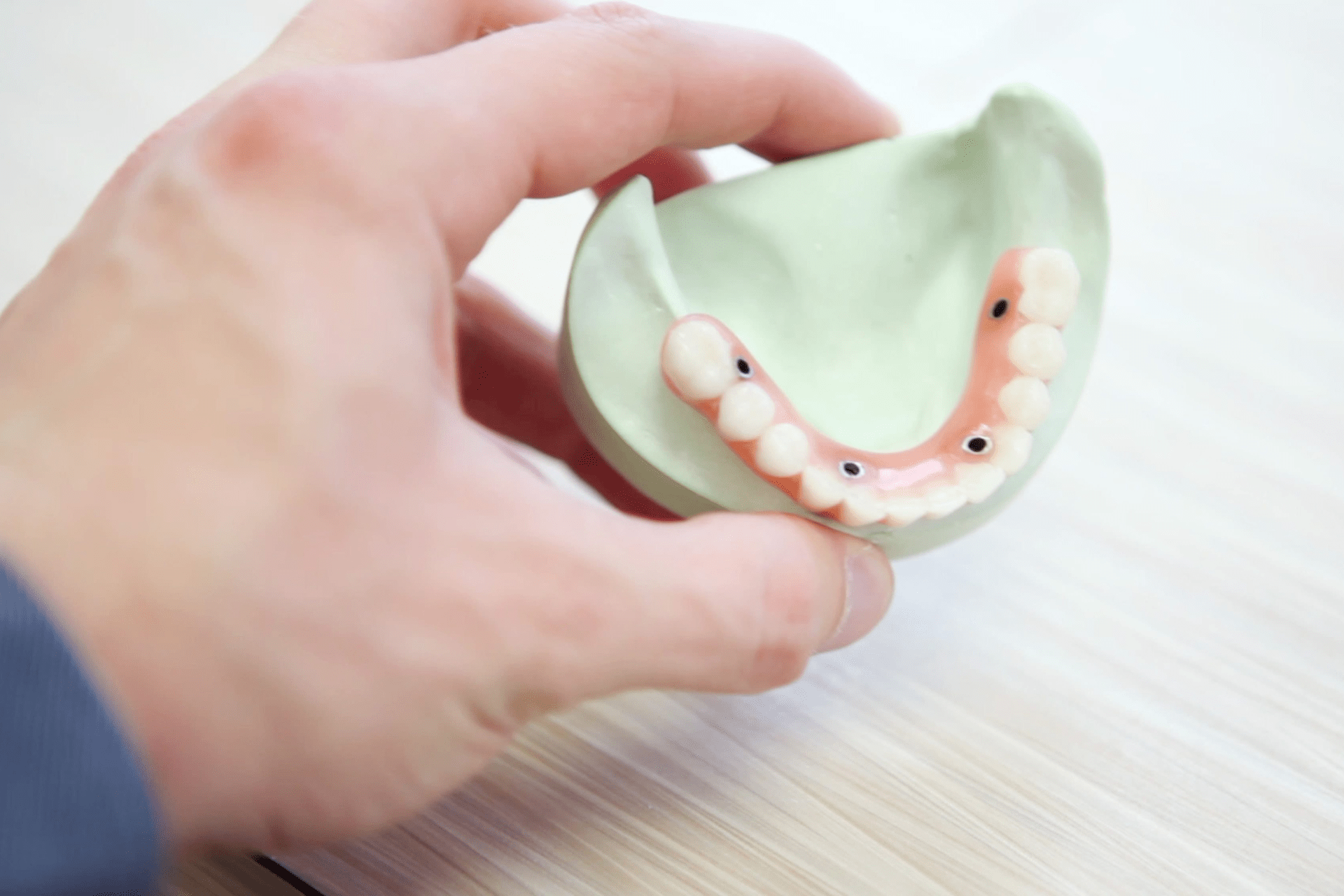 The benefits and drawbacks of dental bridges.